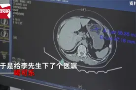 男子患病医生开药竟是2大瓶可乐，1天100ml连喝7天后惊喜-治好了视频封面