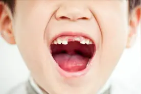 我家孩子牙齿磕掉了该怎么办？还会不会长了？
