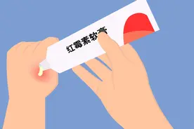 烫伤后可以用红霉素软膏吗？听听皮肤科专业医生怎么说！