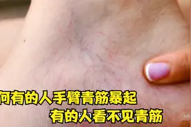 为何有的人手臂“青筋暴起”，有的人看不见青筋，哪种人更健康？视频封面