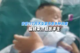 安徽11个月大女婴身患多种疾病 辗转来济就医求生视频封面