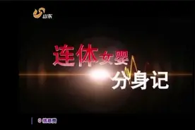 医生奋战5小时，成功将两个女婴分离，这一刻等太久！视频封面