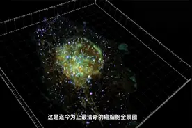 北大手搓显微镜看活的癌细胞视频封面