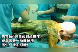 男孩被9吨重收割机碾压，全身露骨一抖就掉渣，医生：惨不忍睹视频封面