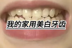 我的家用美白牙齿，20天见证奇迹！视频封面