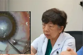 记者带你近距离地观摩一场近视手术视频封面
