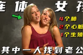 女孩拥有两个头一个身体，其中一个女孩还找到老公视频封面