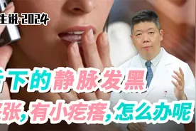 程凯养生说·2024：舌下的静脉发黑，怒张，有小疙瘩，怎么办呢？视频封面