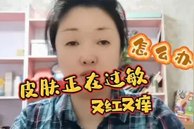 皮肤正在过敏又红又痒怎么办？教你一个好方法，帮你快速镇敏退红视频封面
