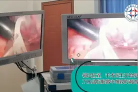 腹腔镜下卵巢囊肿切除全过程（22）视频封面