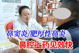 男子鼻窦炎6年多，鼻腔精准给药，一次就明显改善，下次不用来了视频封面