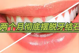 两个月彻底摆脱牙结石，巴氏刷牙法助力口腔健康！视频封面