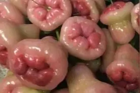 痔疮便血长肉球！过来人含泪分享居家治疗全过程！28天轻松消除！视频封面