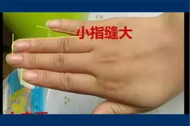 无名指与小拇指出现“指缝”的手相