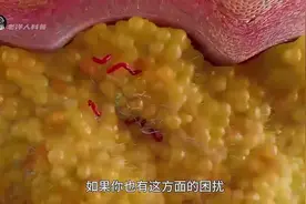 脂肪是怎么排出体外的，一定要看到最后！视频封面