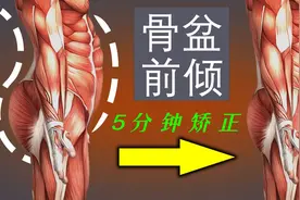 5分钟体态纠正，矫正骨盆前倾视频封面