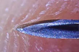 你的粉刺里有什么？传说里面藏着宇宙星图，你从未了解的微观世界