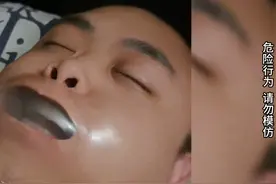 男子打呼噌被妻子用“止鼾神器”封嘴 效果一言难尽视频封面