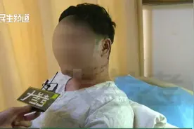 小伙带状疱疹从脸长到头，医生：严重可损害听神经或导致面瘫视频封面