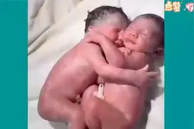 记录双胞胎胎儿出生全过程，妈妈太伟大了视频封面