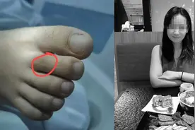 致死伤口曝光！27岁女游客被蛇咬身亡：脚趾有一个小口 较难发现