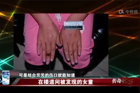 父母用烟头烫得女孩满身是伤，被抓后拒不认错，撒谎说她自己烫的视频封面