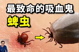 吸血后膨胀上百倍，杀伤力远超蚊子！蜱虫叮咬致死事件暴增的真相视频封面