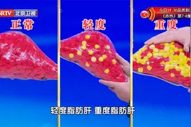 脂肪肝的脂肪长在哪？又是怎么影响肝脏工作的？结合道具给您解答