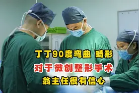 丁丁90度弯曲 畸形 对于微创整形手术 翁主任很有信心