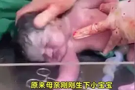 医生全力抢救新生宝宝，大家看到最后是否有奇迹出现…视频封面