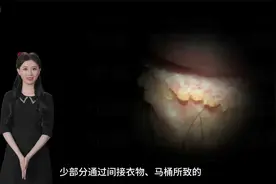 3.7冠状沟长为什么会长尖锐湿疣的原因视频封面