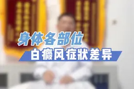 身体各部位白癜风，症状表现大不同，一看就懂！视频封面