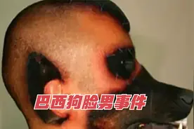 男子从小认为自己就是狗，长大后把自己整成狗头人！真相是什么？