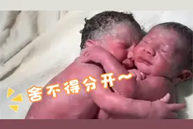 龙凤胎“拥抱”一起出生，所有人都被感动，医生却说不是双胞胎视频封面