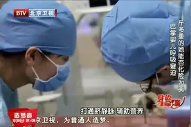 怀孕7月被迫生下巴掌大的婴儿，在医生细心呵护下终于顺利成长！