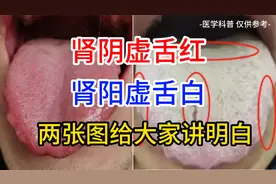 肾阴虚舌红，肾阳虚舌白，两张图讲明白视频封面