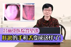 肝气郁结的厉害了，看看手和舌头都变成啥样了！2分钟看明白！