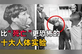 比死亡更恐怖的10大人体实验，你以为活剖人体就算残忍吗？视频封面