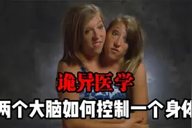 最诡异的双头连体人，两个大脑如何控制一个身躯？洞房怎么办？视频封面