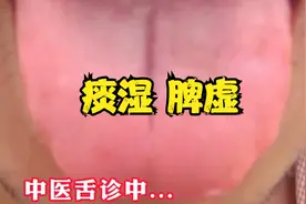 中医舌诊：舌质发红，中间有裂纹，这是痰湿脾虚的症状视频封面