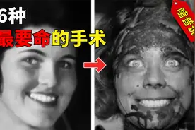 史上最可怕的6大手术，痛的人头皮发麻，看看你体验过几种？视频封面