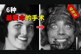 史上最可怕的6大手术，痛的人头皮发麻，看看你体验过几种？视频封面