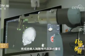 主刀医生依靠面前的电脑和大屏幕，远程遥控手术机器人完成手术视频封面