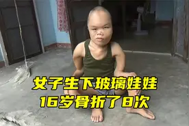 女子生下玻璃娃娃，16岁骨折了8次，不听劝执意生子，她后悔了吗视频封面