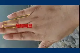 无名指与中指出现“指缝”的手相