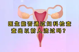 医生能通过妇科检查查出以前人流过吗？视频封面