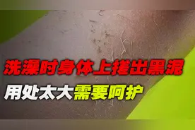 洗澡时身体上搓出黑泥，用处太大需要呵护，这可不代表自己脏！视频封面