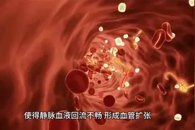 腿上出现红血丝或是疾病信号视频封面