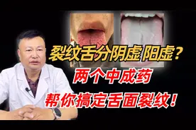 裂纹舌是阴虚还是阳虚？两个中成药，帮你搞定舌面裂纹！