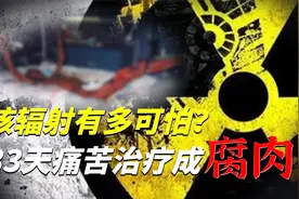日式恐怖纪录片，记录人体遭遇核辐射后83天的可怕反应！视频封面